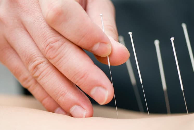 Ce Fear Acupuncture - Fertility acupuncture clinic