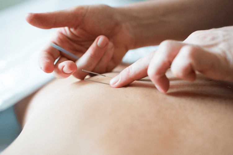 Dr. Michelle Bouton DACM, Acupuncturist - Fertility acupuncture clinic