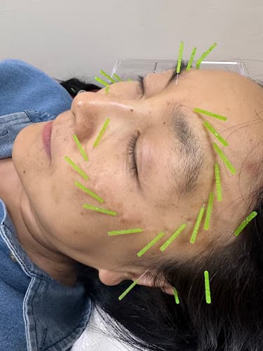 Hialeah Acupuncture Inc. - Fertility acupuncture clinic