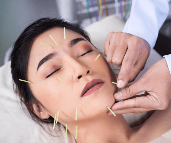 Silver Acupuncture - Fertility acupuncture clinic