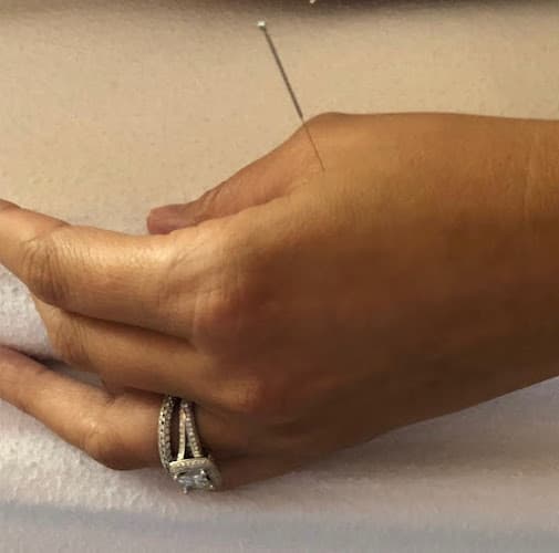 Barrocas Acupuncture and Wellness - Fertility acupuncture clinic