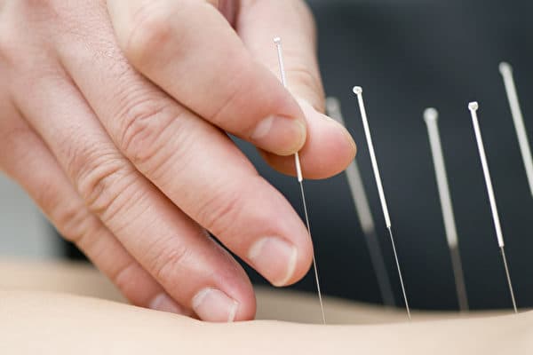 Acupuncture With Over 45 Years Experience - Fertility acupuncture clinic
