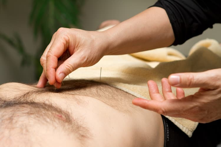 Acupuncture POINTS Your Way to Health - Fertility acupuncture clinic