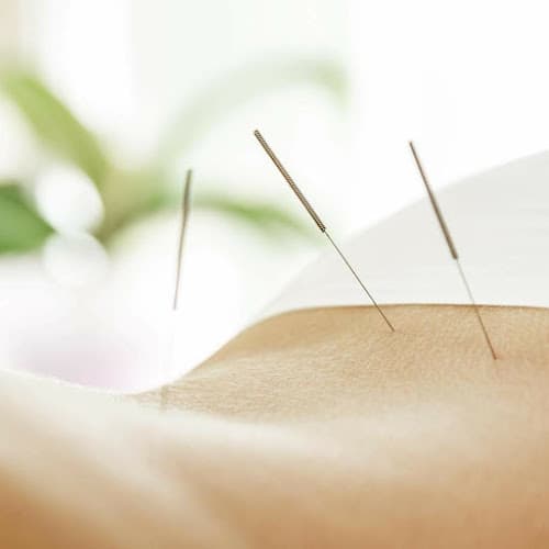 LouLou Piscatore - Integrative Acupuncture - Fertility acupuncture clinic